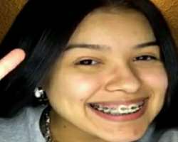 She uses braces to correct her teeth.